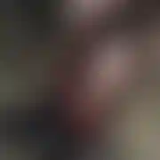 Techni