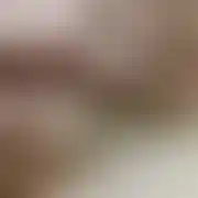 Oral2