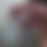 Milkingprostata