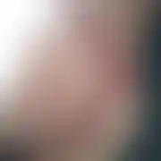 Onet