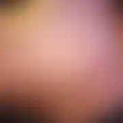 Deny1
