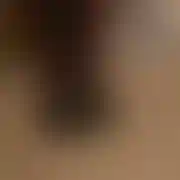 Skin14