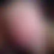 KMkiss