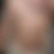 Stalma44