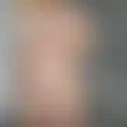 Amypara