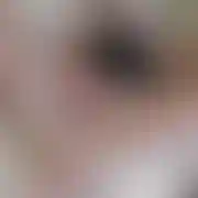 Nickus