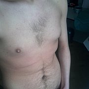 Hcl1 - mężczyzna, 57 lat, Łódź