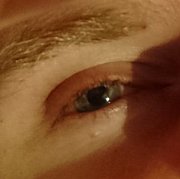 Ptomaro - muž, 41 let, Kutno