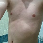 D1D2 - мужчина, 38 лет, Gdańsk