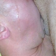 Tube79