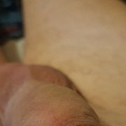 Napaleni - para (kobieta 50 lat, mężczyzna 45 lat), Jastrzębie-Zdrój