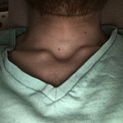 Mofos - мужчина, 32 лет, Słupsk