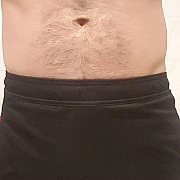 Q1988 - mężczyzna, 37 lat, Wrocław