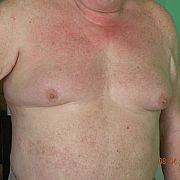 Bielski - mężczyzna, 72 lat, Bielsko-Biała