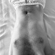 Kneelingsolvesproblems - man, 35 years, Warszawa