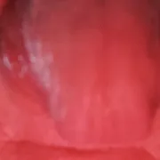 Po199mL