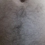 RZ