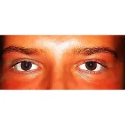 FotoArt