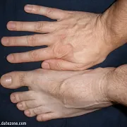Fistaszek5