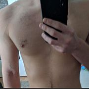 Dn19 - muž, 26 let, Rzeszów