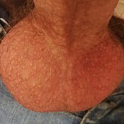 Apgar - muž, 27 let, Ciechanów