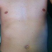 Mc1587 - чоловік, 37 років, Sosnowiec