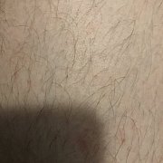 Colo1234 - чоловік, 25 років, Koszalin