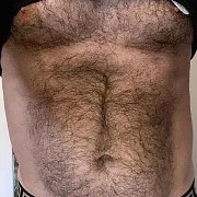 Versi1