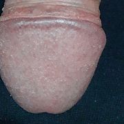 Ratann - man, 41 years, Łódź