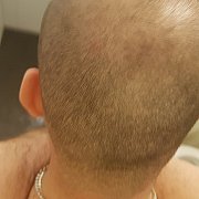 Kotleciak15 - чоловік, 36 років, Szczecin