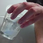 Milkingprostata