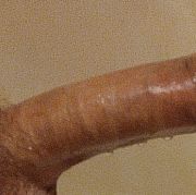 Rubens36