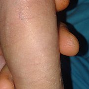 PiotrusPan1992 - mann, 33 Jahre, Szczecin