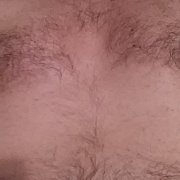 Xray - mężczyzna, 49 lat, Gliwice