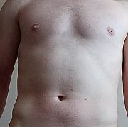 Rad15 - muž, 35 let, Łódź