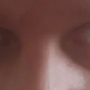 Goldberg