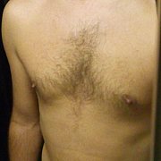 Robert1234567890a - man, 103 years, Katowice