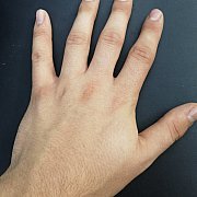 Fuckanal1 - man, 30 years, Recz