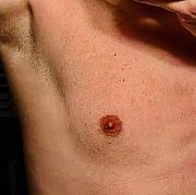 SeksualnieNiebezpiecznie