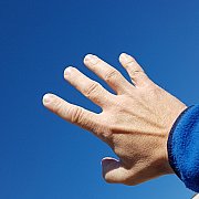 C155 - мужчина, 40 лет, Mielec