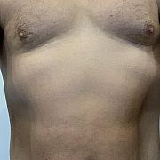 Ten123456789101112 - mężczyzna, 45 lat, Milicz