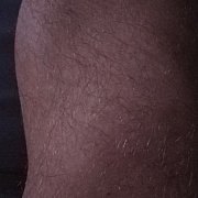 Vittelove - пара (чоловік 32 років, жінка 29 років), Berlin