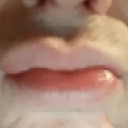 69Lizak