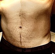 Milyxxl - мужчина, 42 лет, Toruń