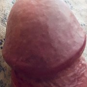 GrubyIntensywnyTwardyGIT - muž, 41 let, Euskirchen