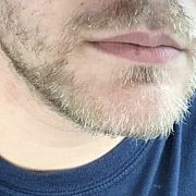 Rehab - man, 47 years, Szczecin