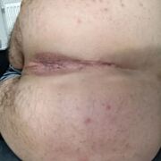 MlodaDupcia - mężczyzna, 22 lat, Rakoniewice