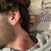 Igoreq - mężczyzna, 23 lat, Ostrołęka