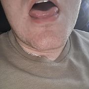 Passivebald - man, 33 years, Poznań