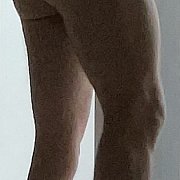 Abciksimab - mężczyzna, 40 lat, Gniezno